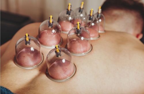 Detox Cupping Therapy Service