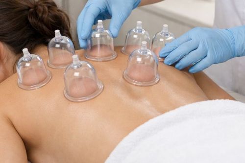 Hijama Cupping Therapy Service