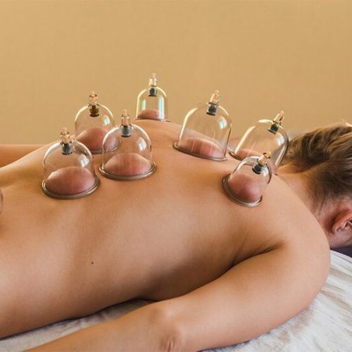 Professional Cupping Therapy Session Service