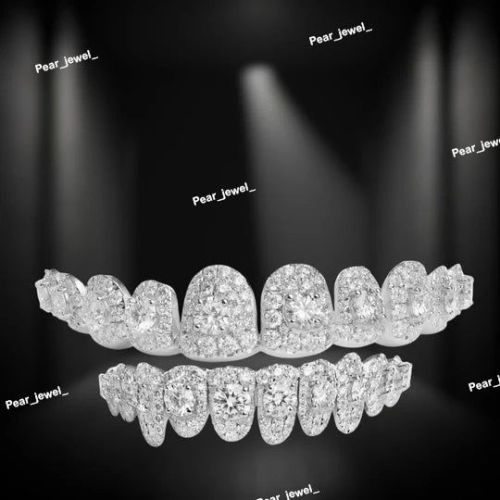 Elite Custom Hip Hop VVS Moissanite 925 Silver Grillz