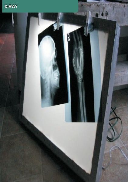 X Ray Viewer