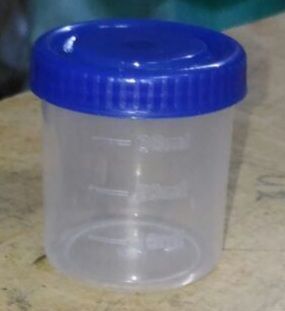 30 ML Urine Container
