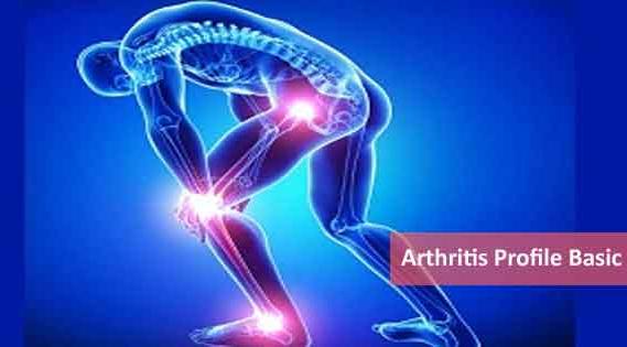 Arthritis Profile