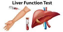 Liver Function Test