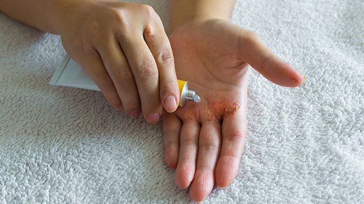 Lignocaine Hydrochloride & Prilocaine Gel