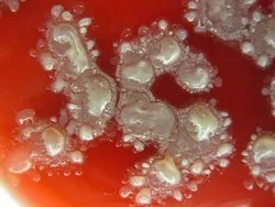 Bacillus Licheniformis