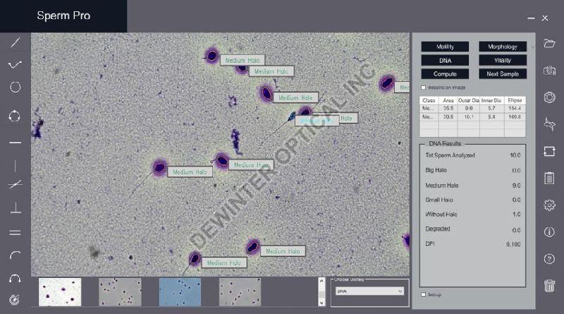 Sperm Pro Computer Aided Sperm Analysis Software