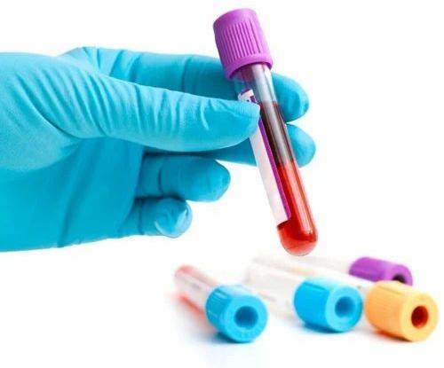 Blood Test Services