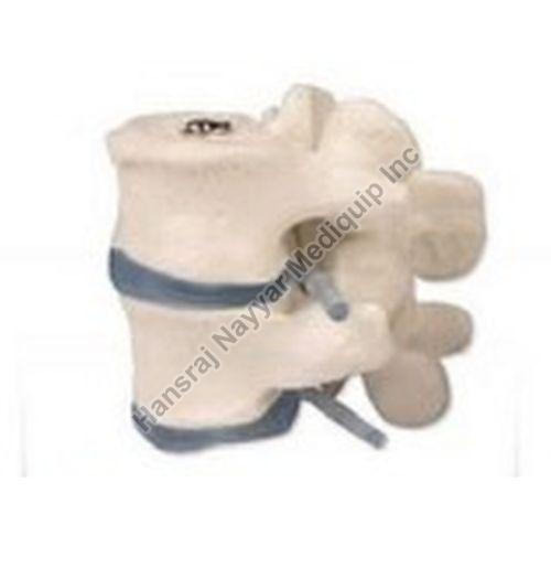 2 Lumbar Vertebrae 3D Anatomical Model