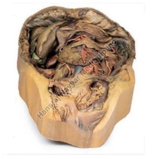Abdomen with Lnguinal Hernia 3D Anatomical Model