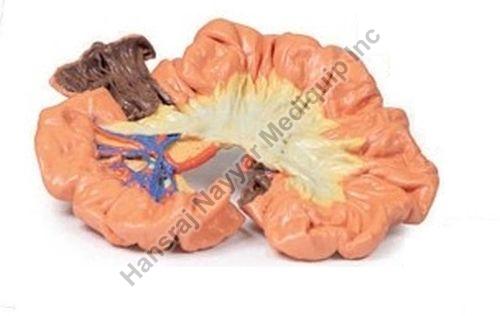 Bowel Portion lleum 3D Anatomical Model