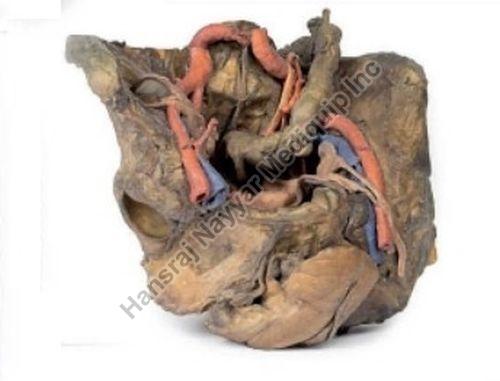 Female Pelvis Deep Dissection 3D Anatomical Model