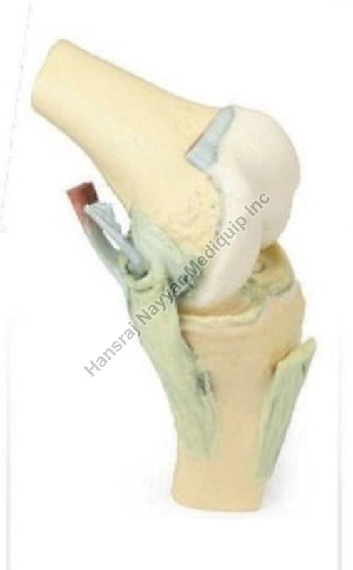 Knee Joint Flexed 3D Anatomical Model