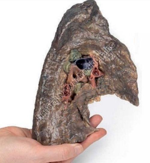 Left Lung Hilum 3D Anatomical Model