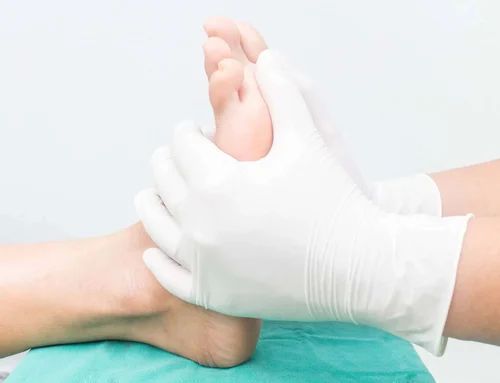 Diabetes Foot Treatment Services