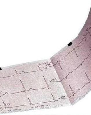 Mac 600 ECG Paper