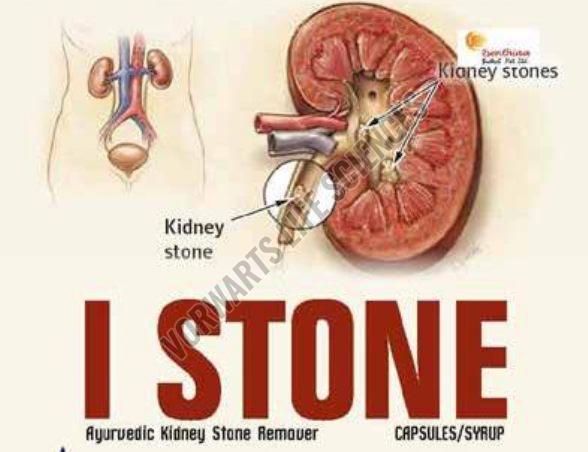 I-Stone Ayurvedic Capsules