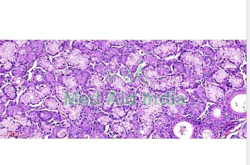 E Slide of Epithelial Lesions