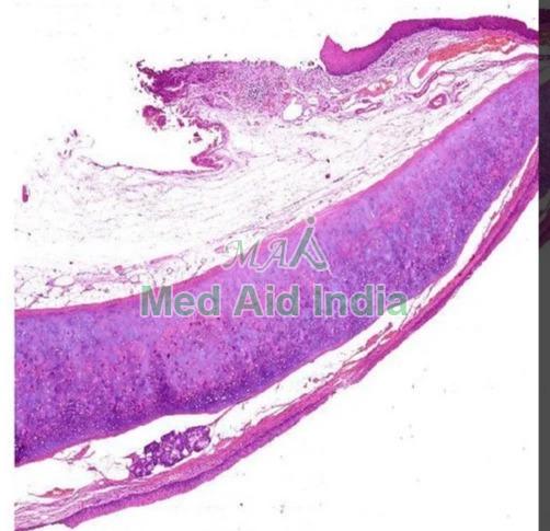 Epiglotis Prepared Microscope Slide