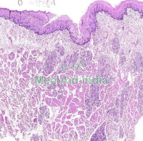 Oral Mucosa E Slide Sets