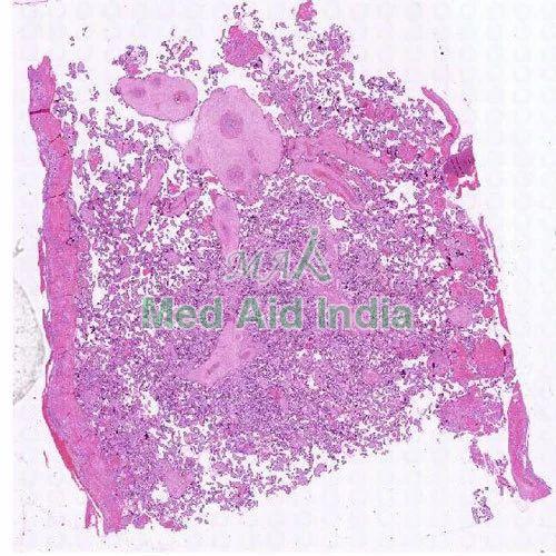 Placenta Microscope Slide