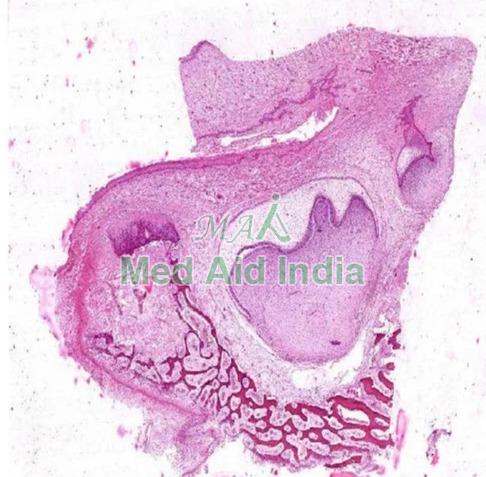 Tooth Germ Development Bell Stage Prepared Microscope Slide