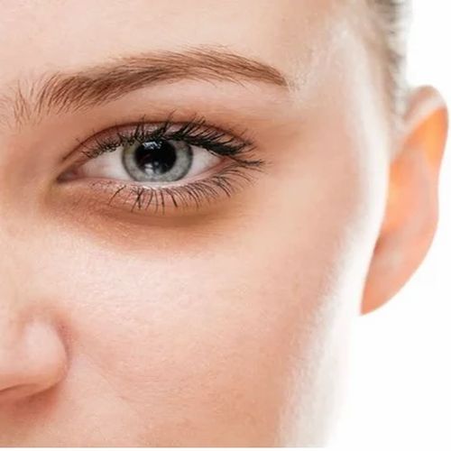 Under Eye Dark Circles Treatment