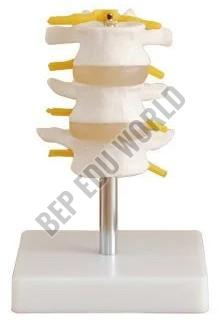 Lumbar Bone Joint Model