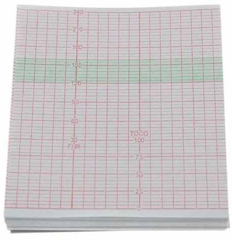Contec Fetal Monitor ECG Paper