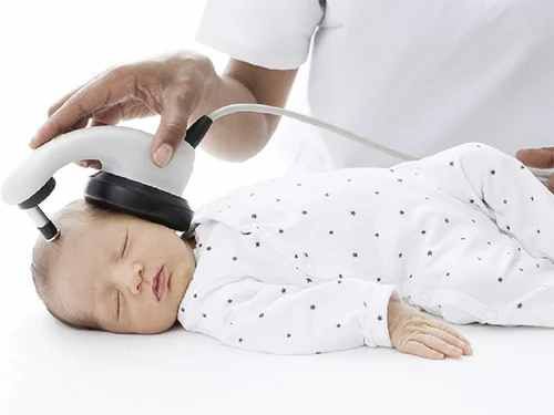 Bera Hearing Test Service