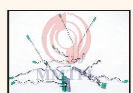 Refractory Anchors 05