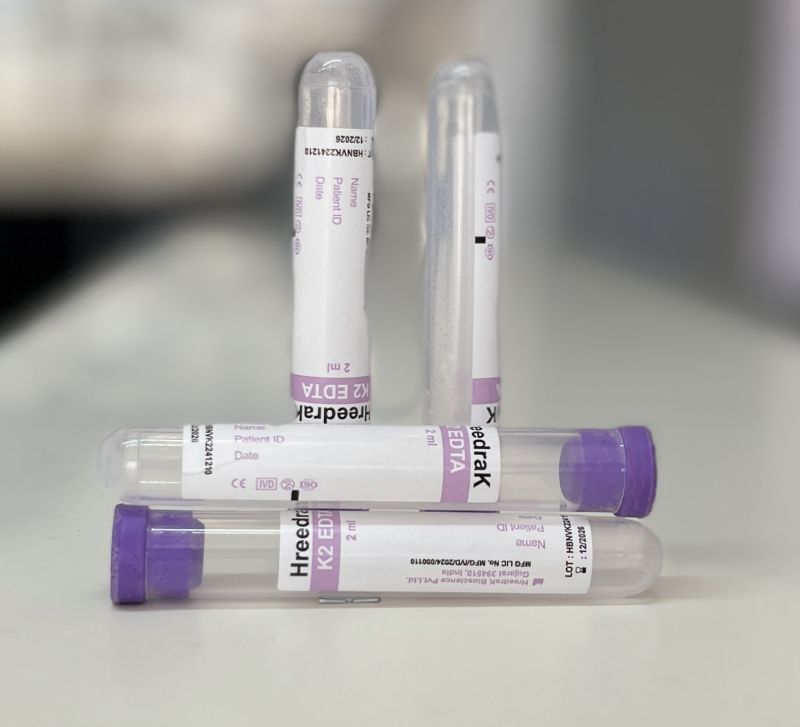 K2 EDTA Non Vacuum Blood Collection Tube