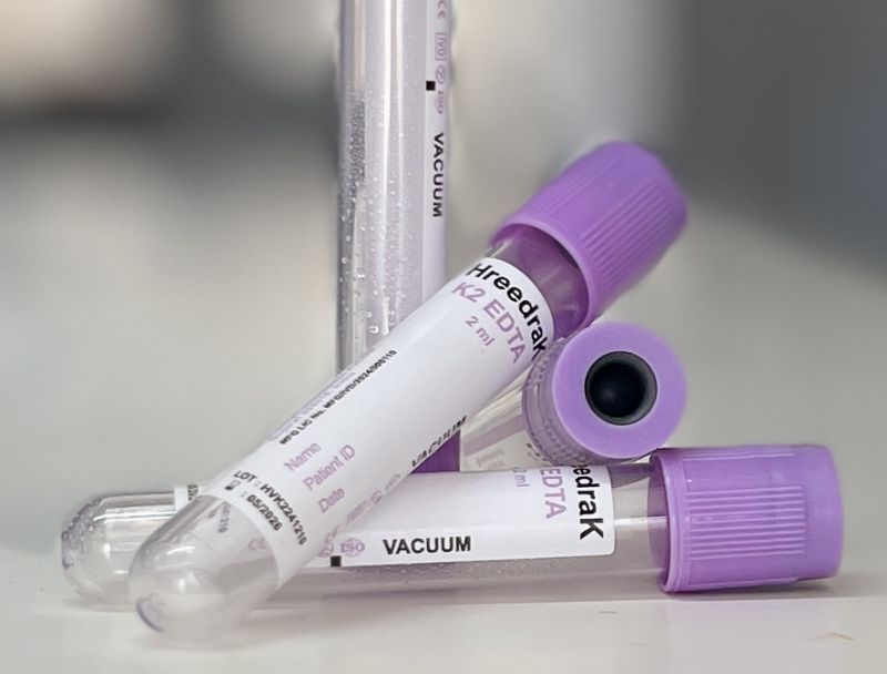 K2 EDTA Vacuum Blood Collection Tube