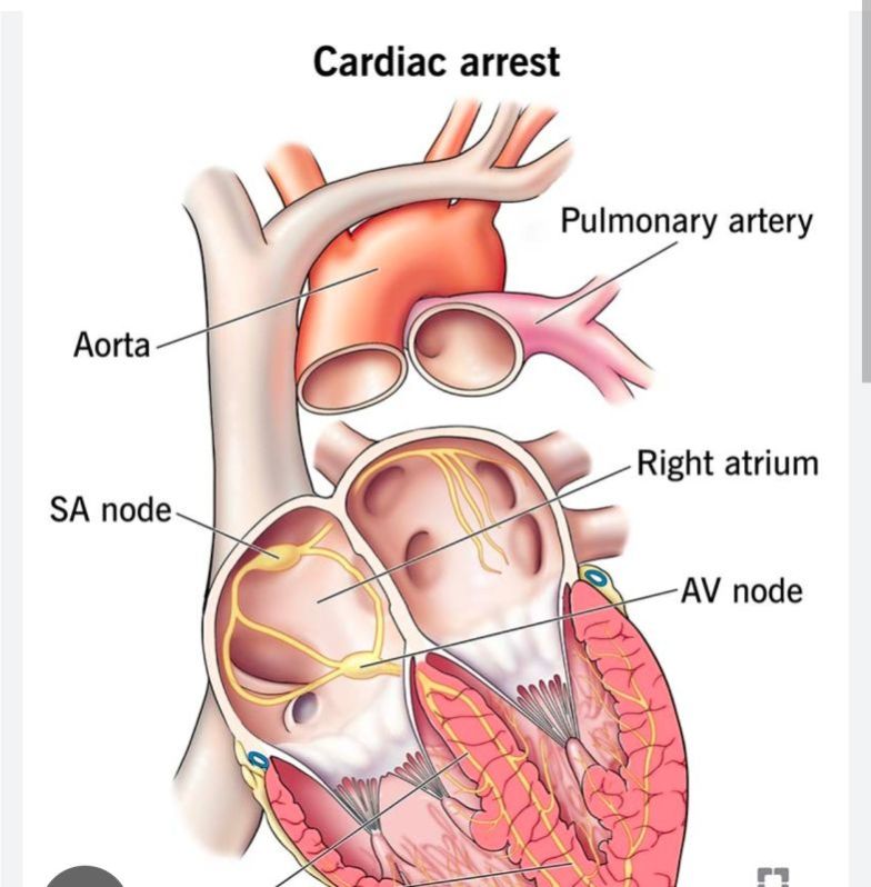 Heart Disease Treatment Service