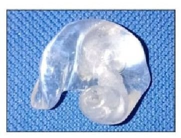 Body Level Ear Mould