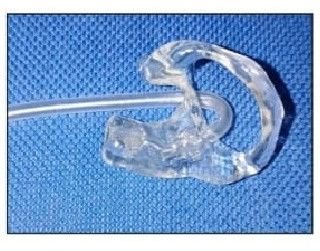 Skeleton Mold Hearing Aids