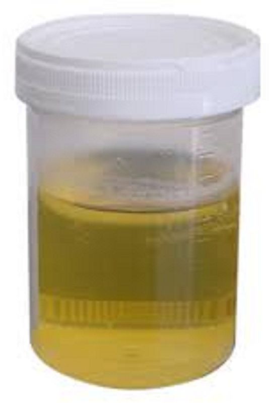 Pure Gir Cow Urine
