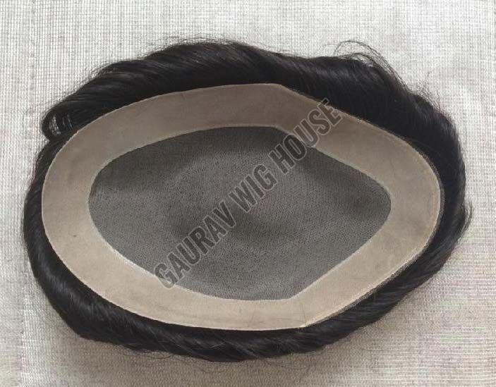 Hair Patches