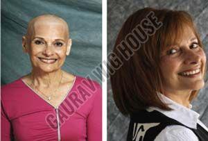 Wigs for Cancer Patients