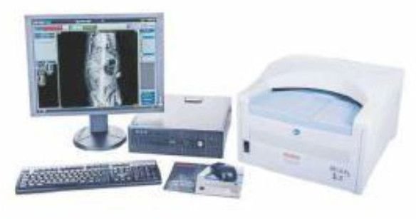 Digital Computed Radiography Imaging System