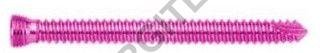 2.7mm Locking Cortex Screw