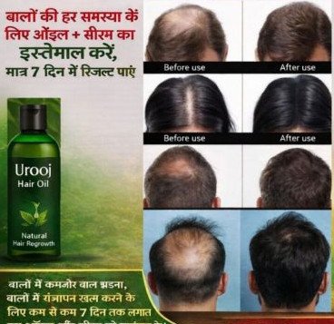 Urooj Natural Hair Regrowth Oil