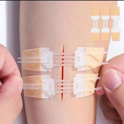 Zip Stitch Elastic Adhesive Bandage
