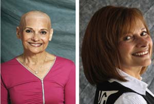 Wigs for Cancer Patients