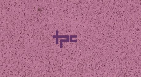 Prime Ceiling Tiles 02