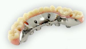 Dental Implant Hybrid Restorations