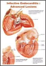 DIFFERENT HUMAN DISEASE CHARTS