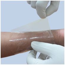 Collagen Film Dressing