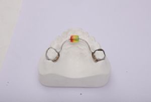 Removable tongue trainer with bead