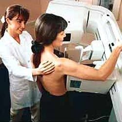 mammography machines